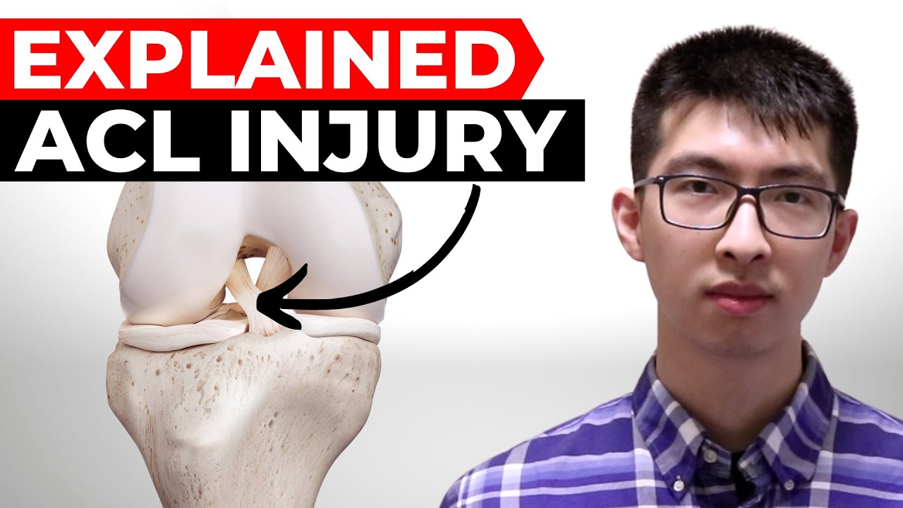 Understand ACL Injury: Do I have ACL Tear (One Mistake to Avoid!)