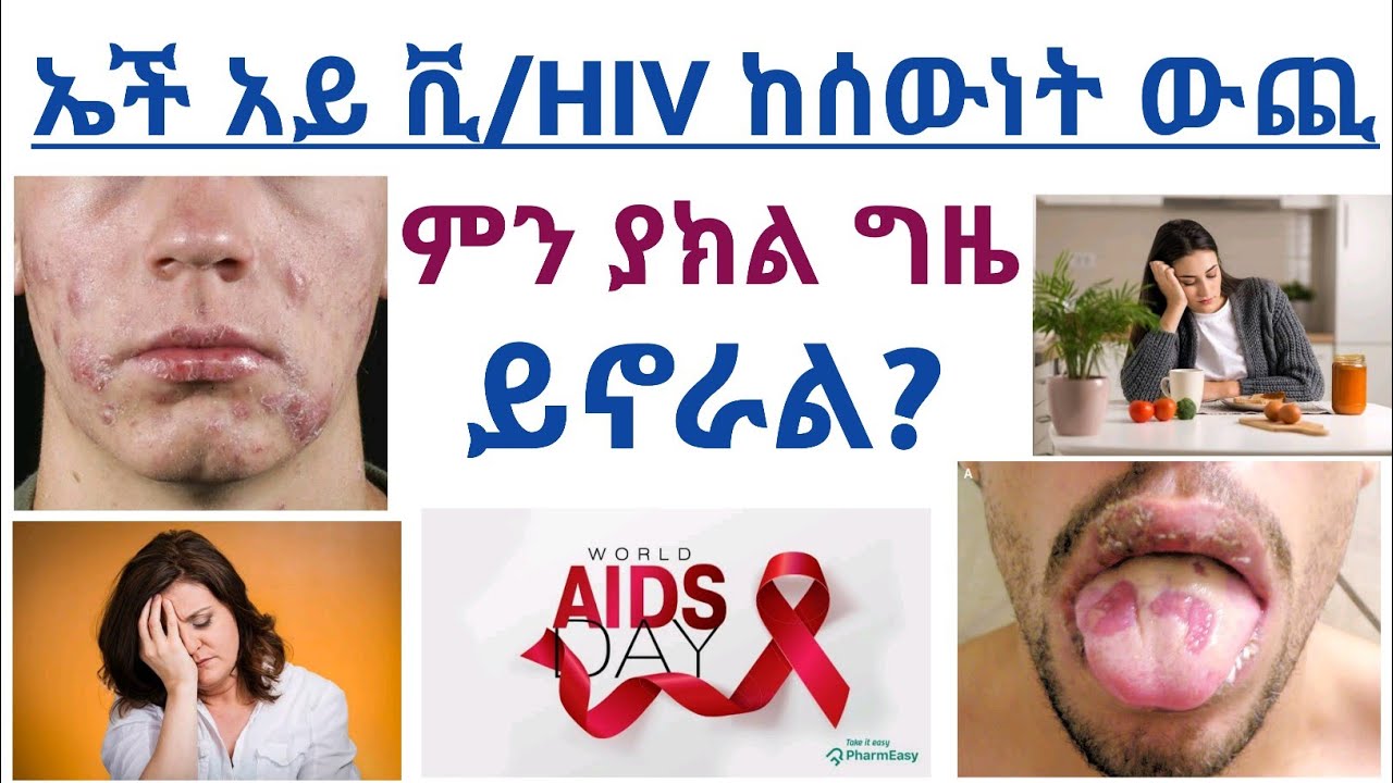 ኤች አይ ቪ ቫይረስ/HIV ከሰውነት ከወጣ ቡሀላ በብረት,በእንጨት,በልብስ እና በተለያዩ ቁሳቁሶች ላይ ቫይረሱ ለምን ያክል ግዜ ይቆያል?