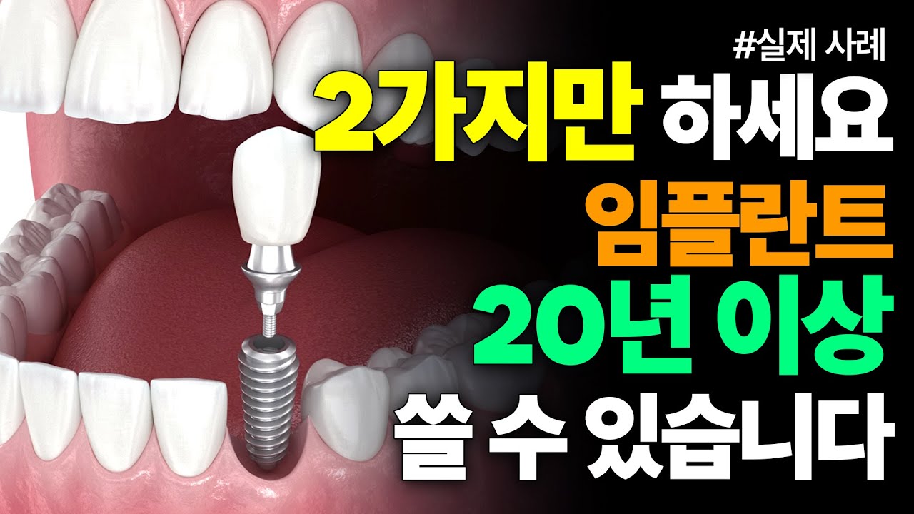 같은 임플란트 20년 쓰는 사람vs3년만에 뽑는 사람 차이점