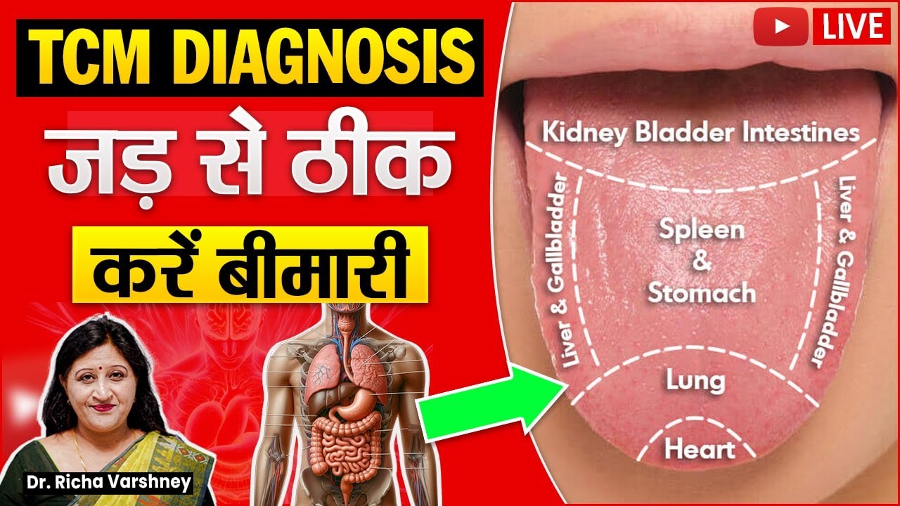 How To Find Root Cause Of Any Health Problem By Tongue Diagnosis || Dr. Richa Varshney