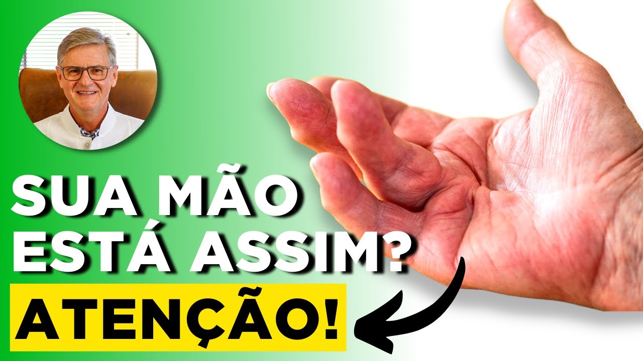 DOENÇA DE DUPUYTREN - Contratura palmar (Sintomas, Diagnósticos e Tratamentos)