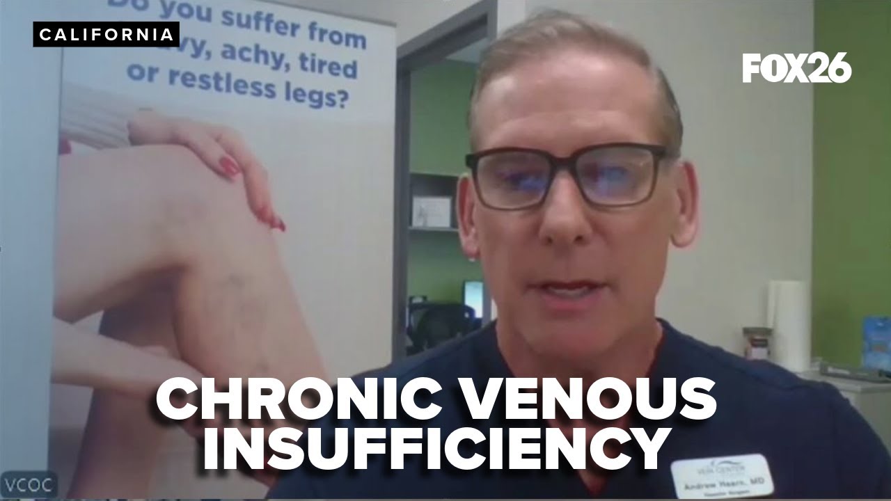 How to treat Chronic Venous Insufficiency