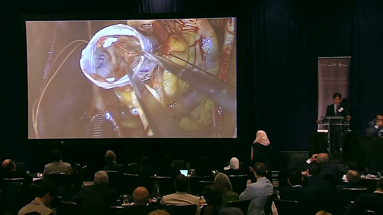 Residual AI after Root Repair: Practical tips - Hiroo Takayama
