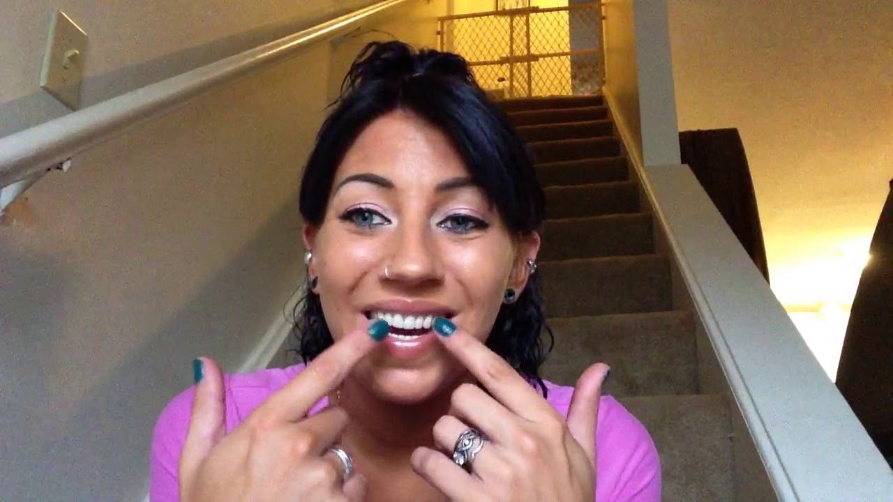 Will people notice you have dentures? 💕