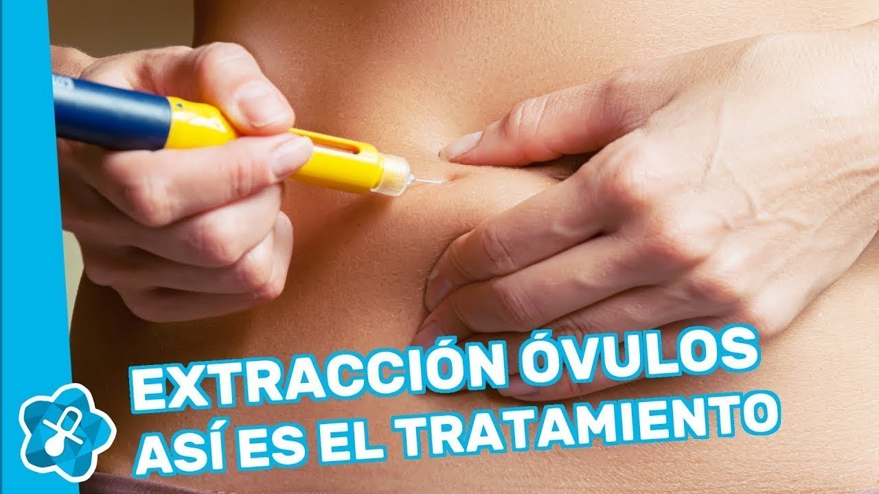 Extracción de óvulos para congelarlos, paso a paso
