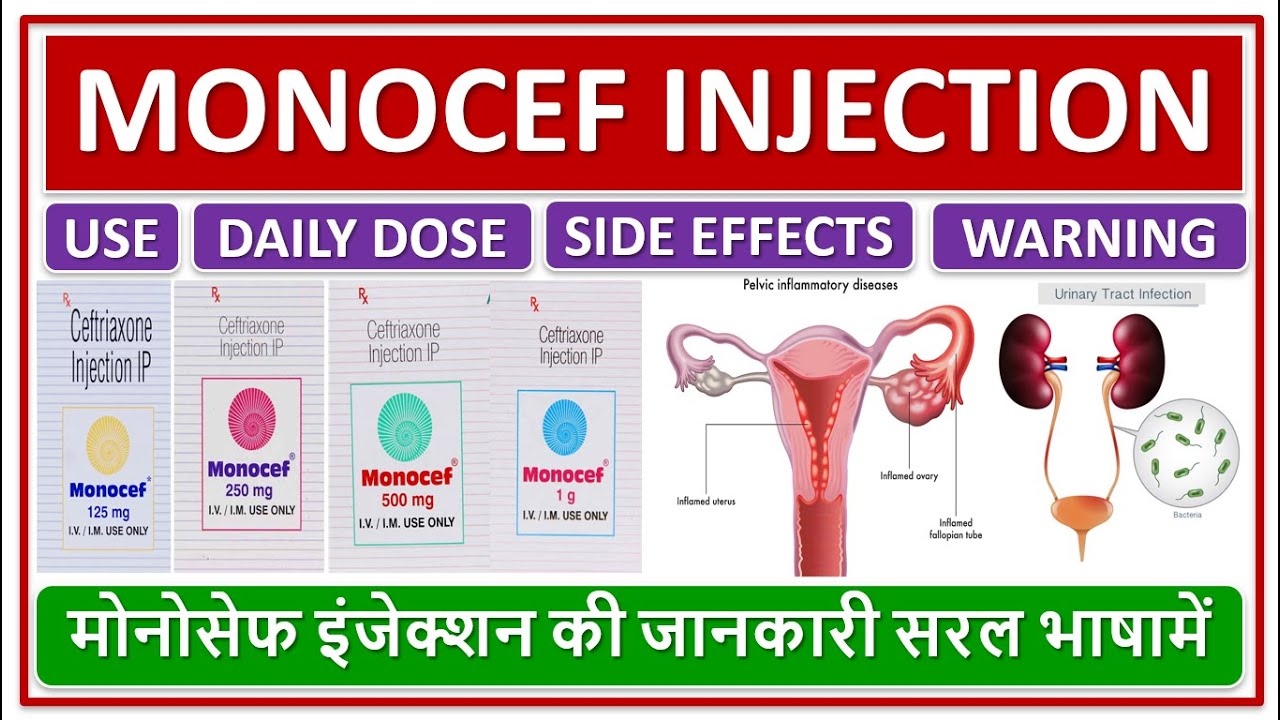 MONOCEF INJECTION, USE, DAILY DOSE, SIDE EFFECTS, WARNINGS, मोनोसेफ इंजेक्शन की जानकारी सरल भाषामें