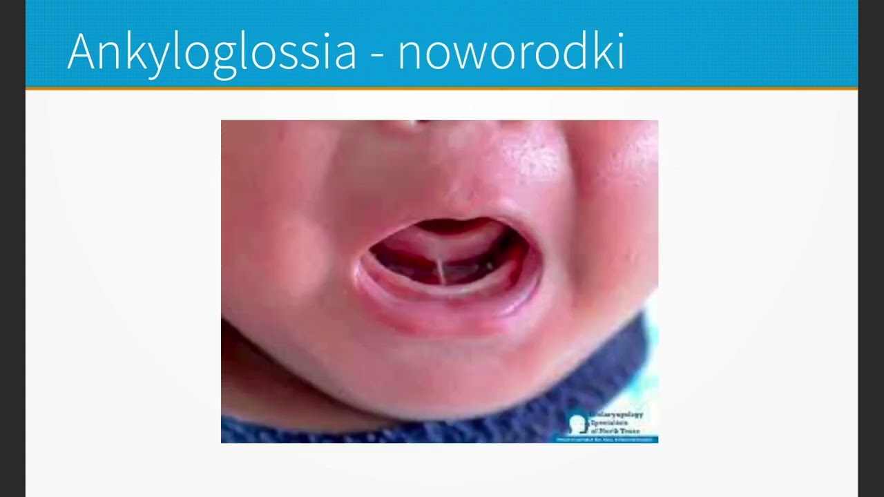 Dysfunkcje i parafunkcje narząd&oacute;w mowy oraz ich wpływ na mowę