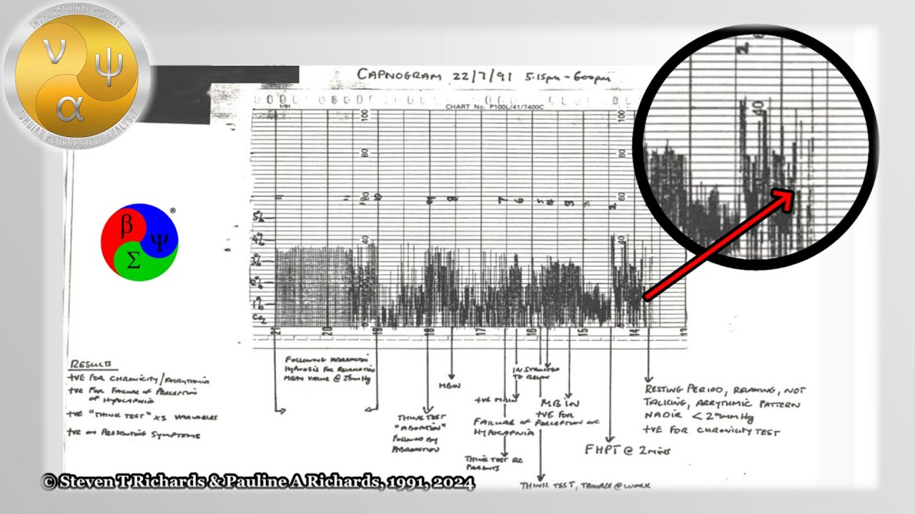 Complex Defence Mechanisms Revealed by Capnography