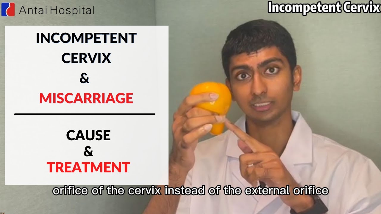 Incompetent Cervix & Late Miscarriage | Miscarriage Causes | Antai Hospital
