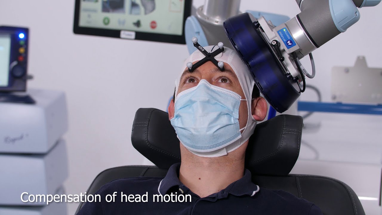 Robotized TMS with TMS-Cobot and optical tracking system - Axilum Robotics with Magstim