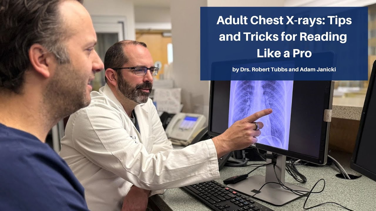 Adult Chest X-rays: Tips and Tricks for Reading Like a Pro | Mastering Emergency Imaging