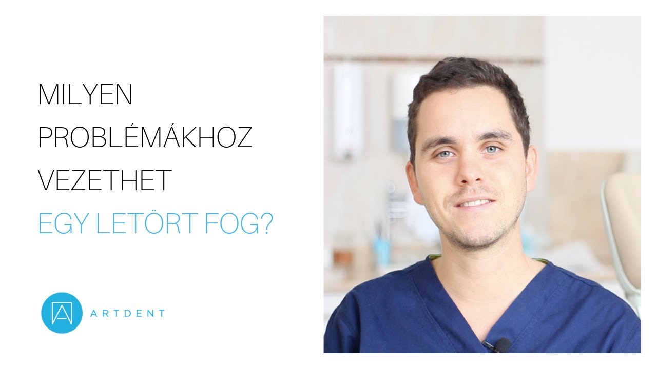 Milyen problémákhoz vezethet egy letört fog?
