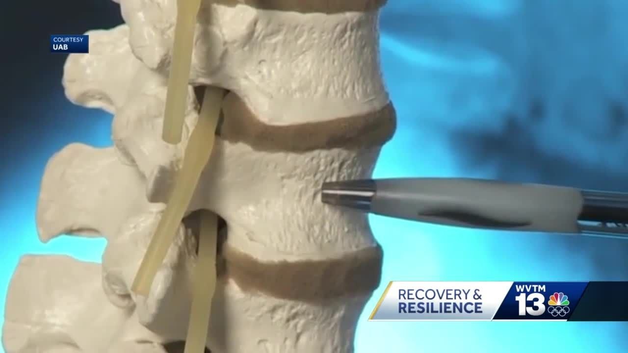 WVTM 13 Chronicle Recovery and Resilience: Chelsea Thrash walking strong