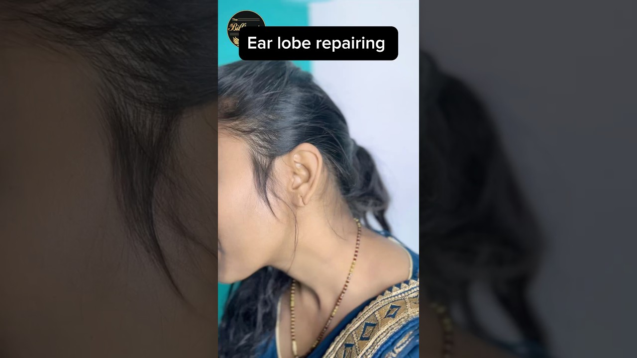 Ear lobe repairing 