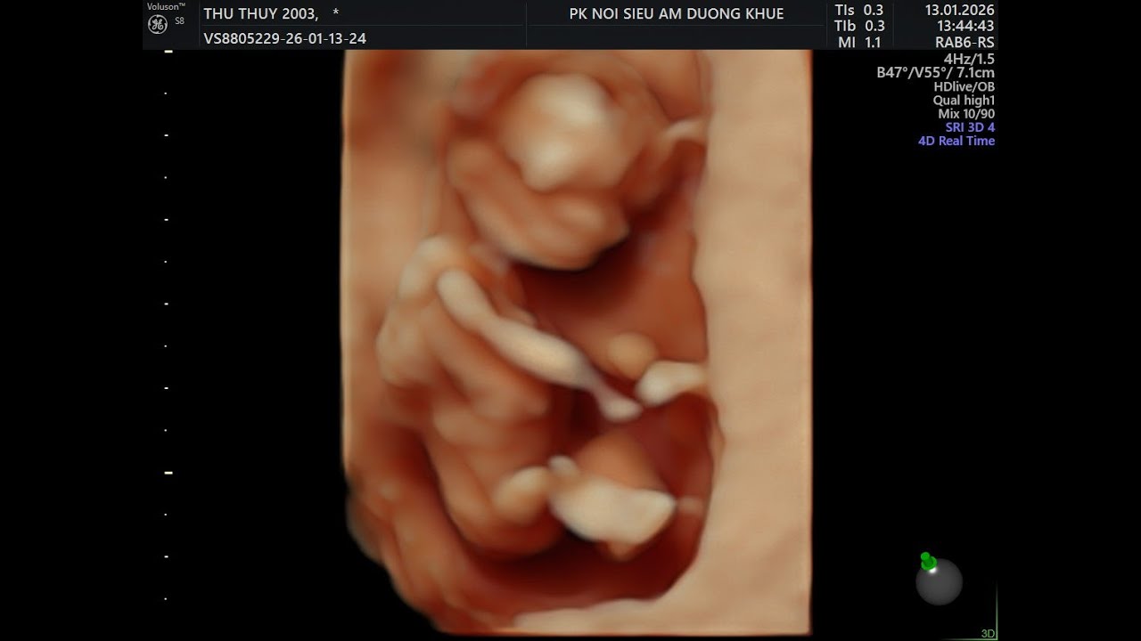 TRƯƠNG THỊ THU THỦY  2003 13 01 2026