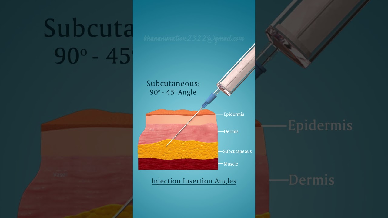 Injection Angles (Degrees) Explained_Intramuscular, Subcutaneous, Intradermal, Intravenous #shorts