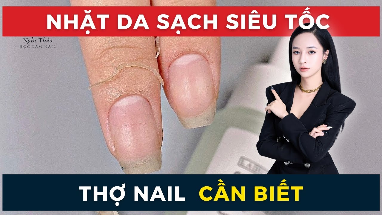Muốn nhặt da nhanh phải biết đến điều này - Cách nhặt da sạch