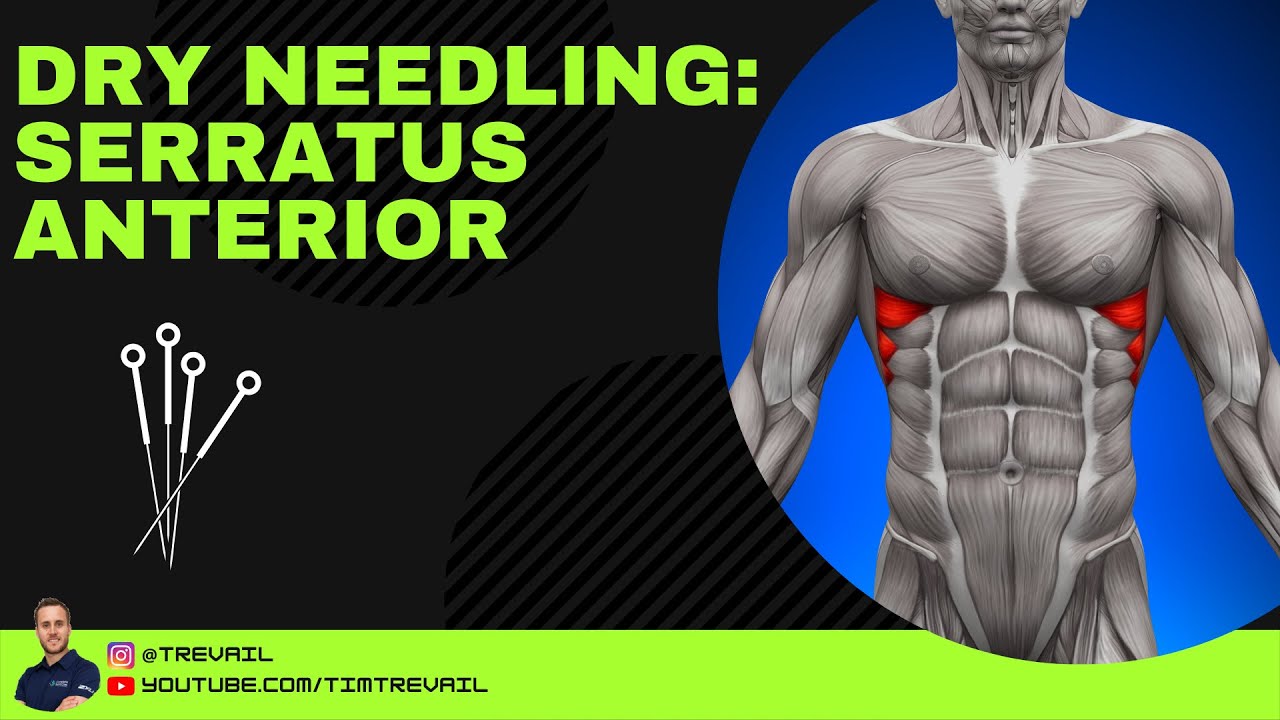 Dry Needling: Serratus Anterior