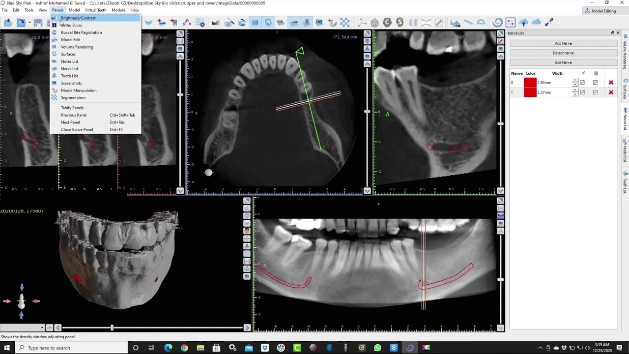 Blue Sky Bio, CBCT implant planning ( part 2 ), Nerve tracing + CBCT crop, Dr Khaled Ekram (Arabic )
