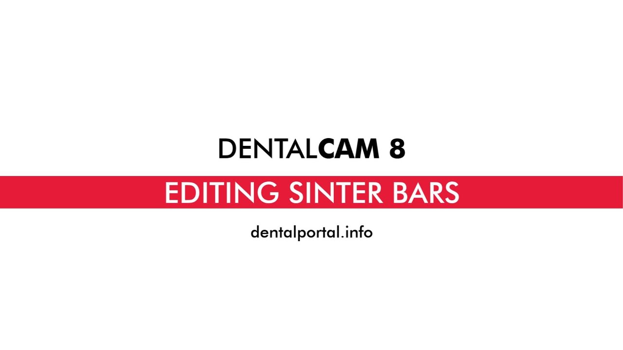 DentalCAM 8 &ndash; Editing sinter bars