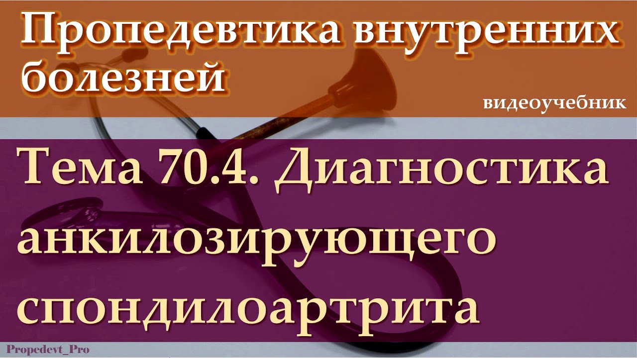 Тема 70.4. Диагностика анкилозирующего спондилоартрита