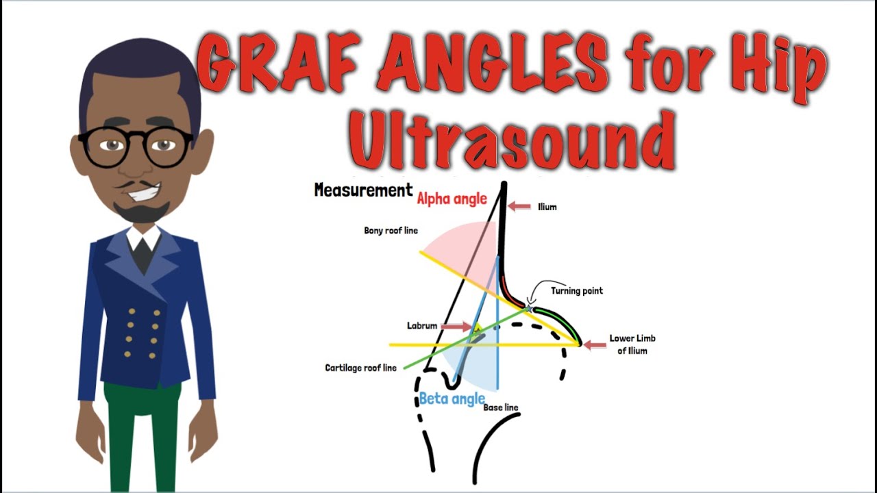 Radiological features - Graf angle measurement Hip Ultrasound