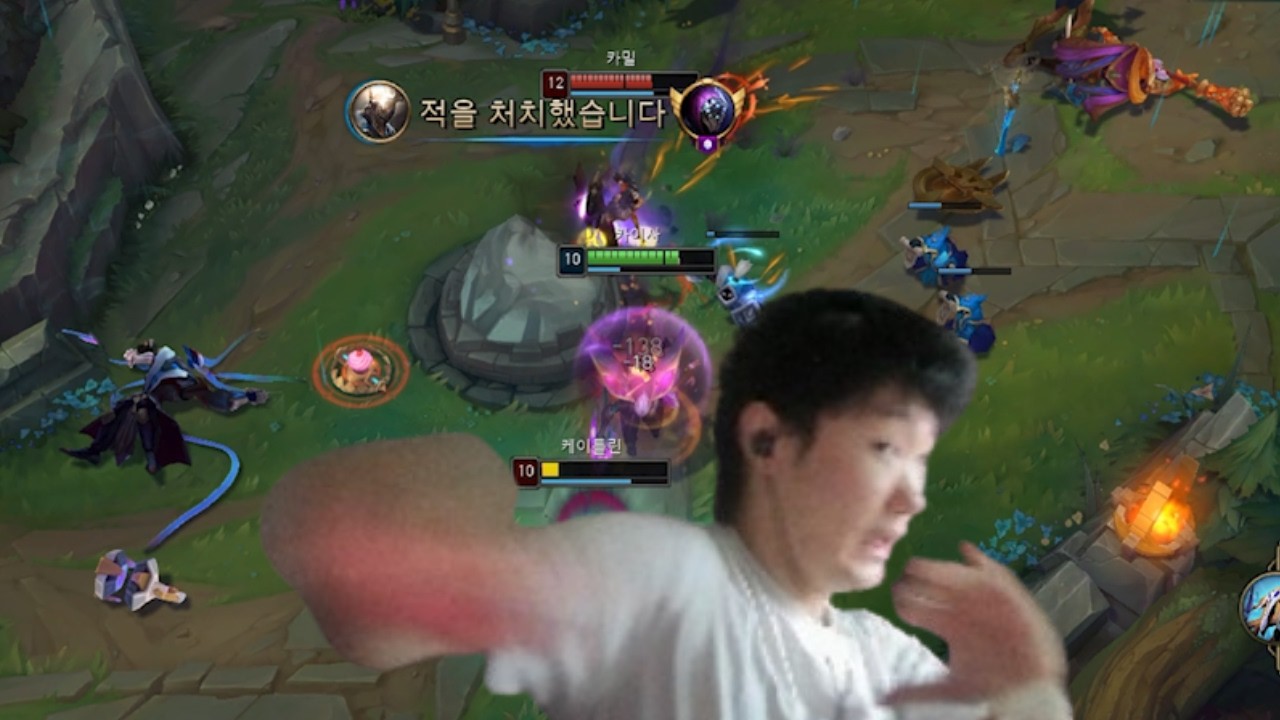 서폿은 거들뿐