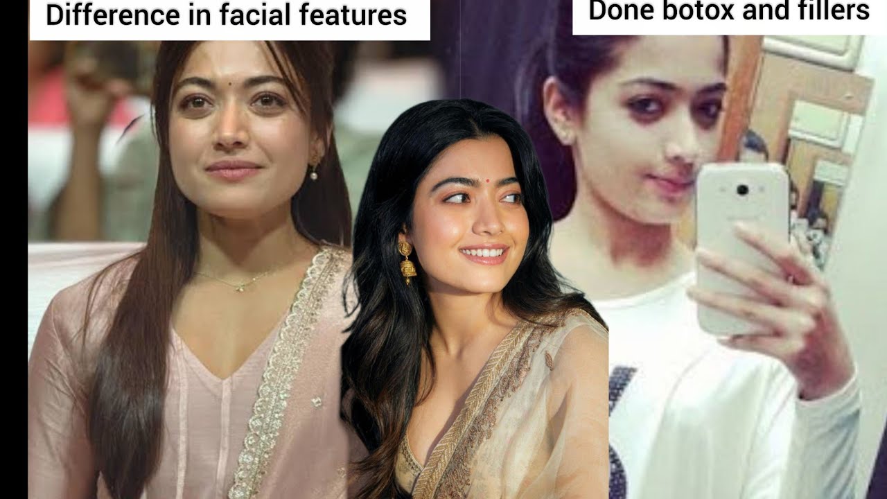 Hase Rashmika Mandhana undergone any cosmetics procedures