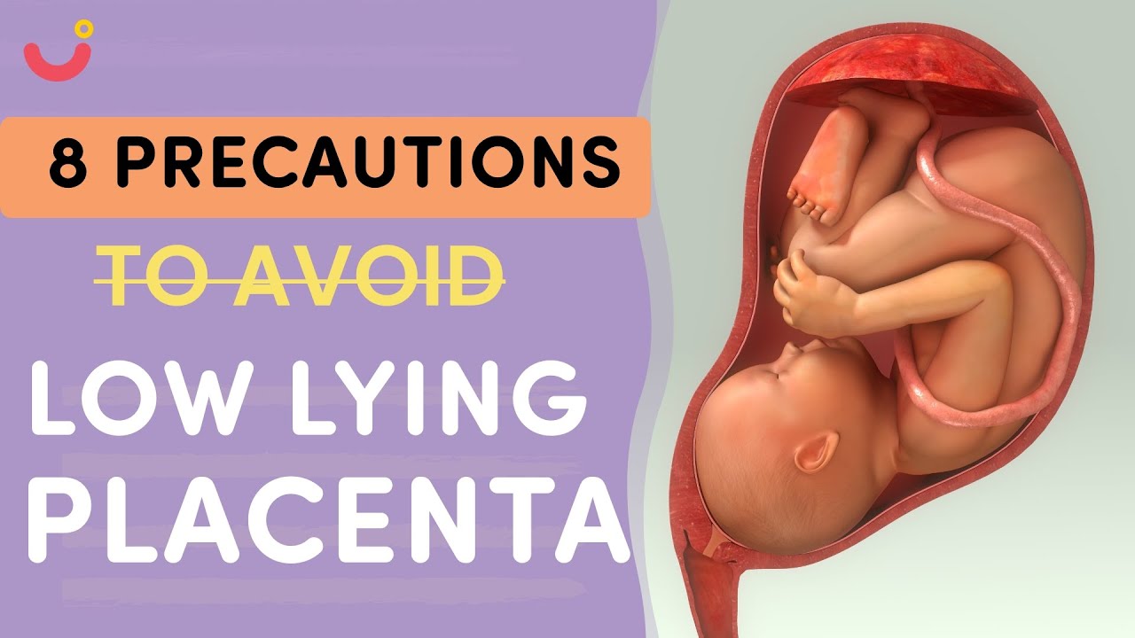 Unlock the Secrets to a Healthy Pregnancy: How to Cure Low Lying Placenta Naturally