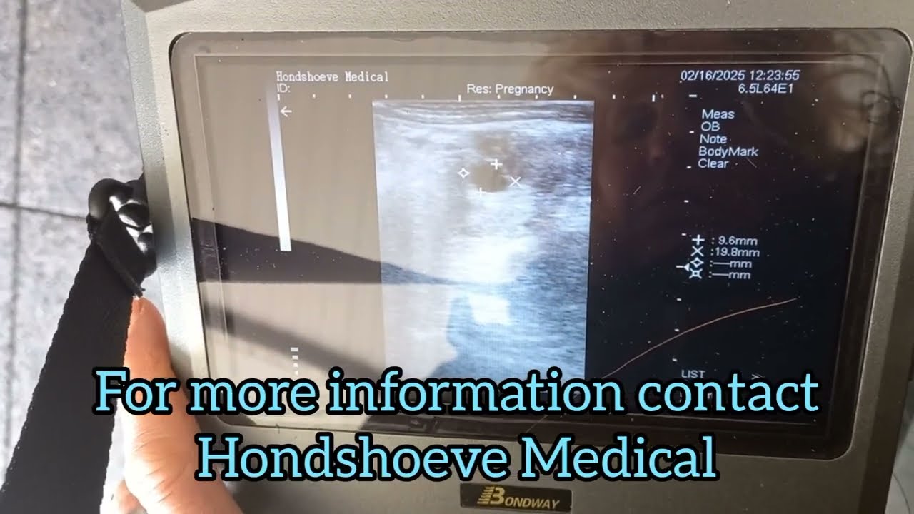 Ultrasound scanner BW590V