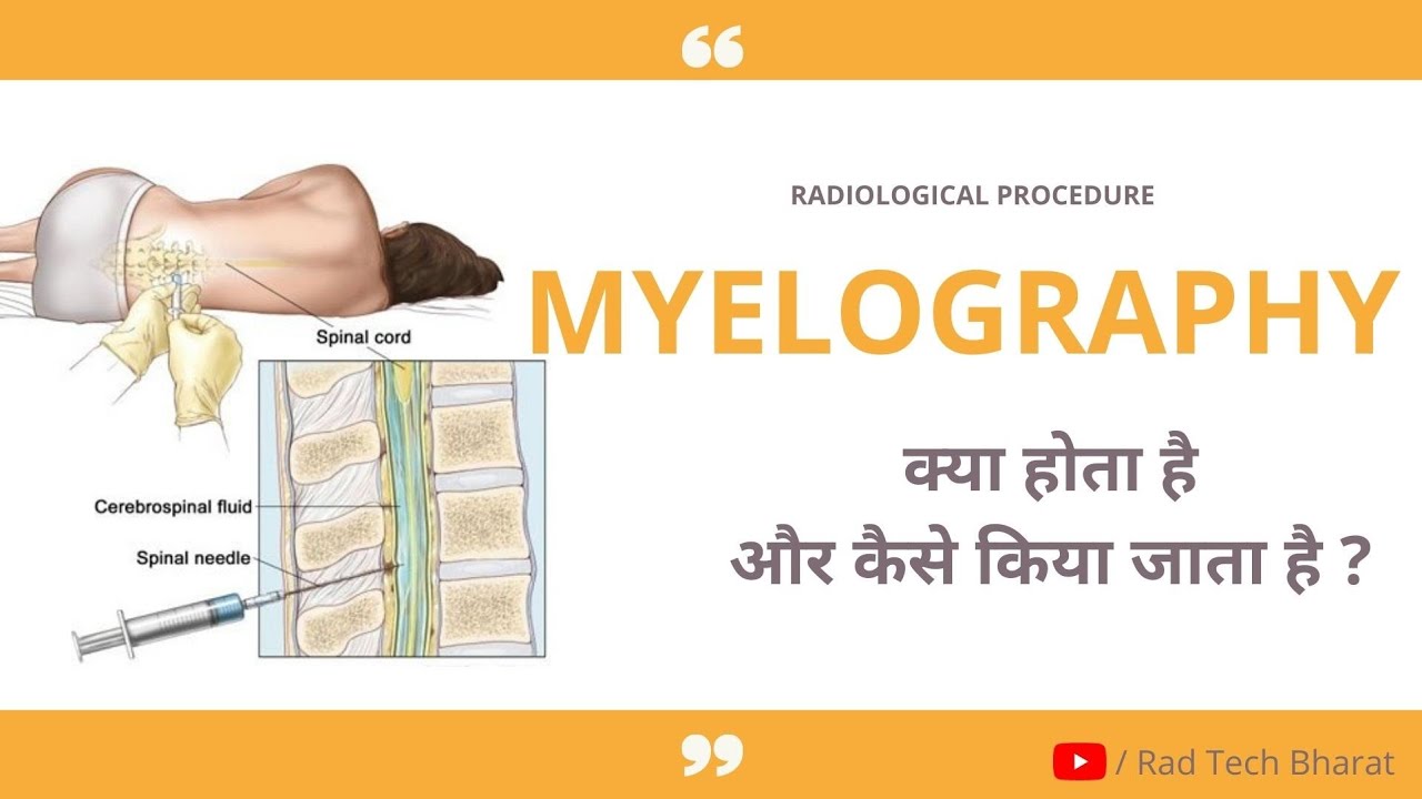 Myelography Procedure क्या होता है और  कैसे किया जाता है ?