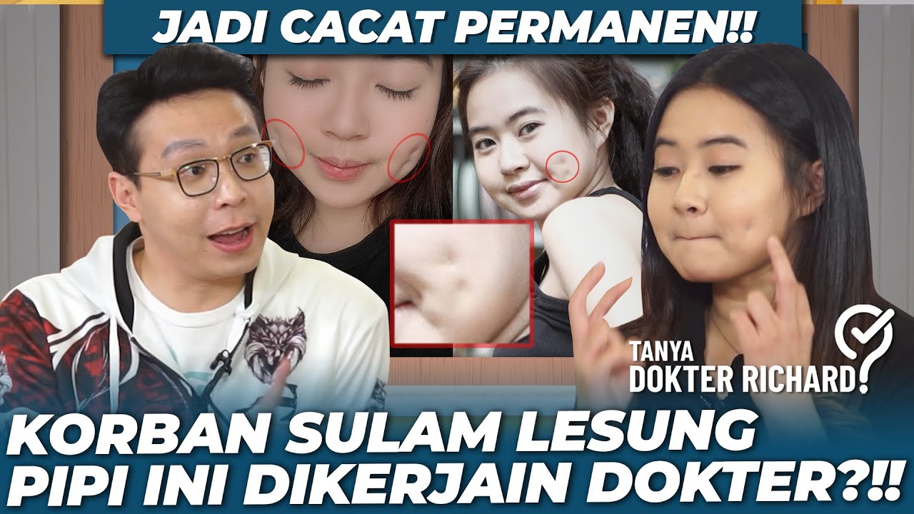KORBAN SULAM LESUNG PIPI INI DIKERJAIN DOKTER?! JADI CACAT PERMANEN!! | TANYA DOKTER RICHARD