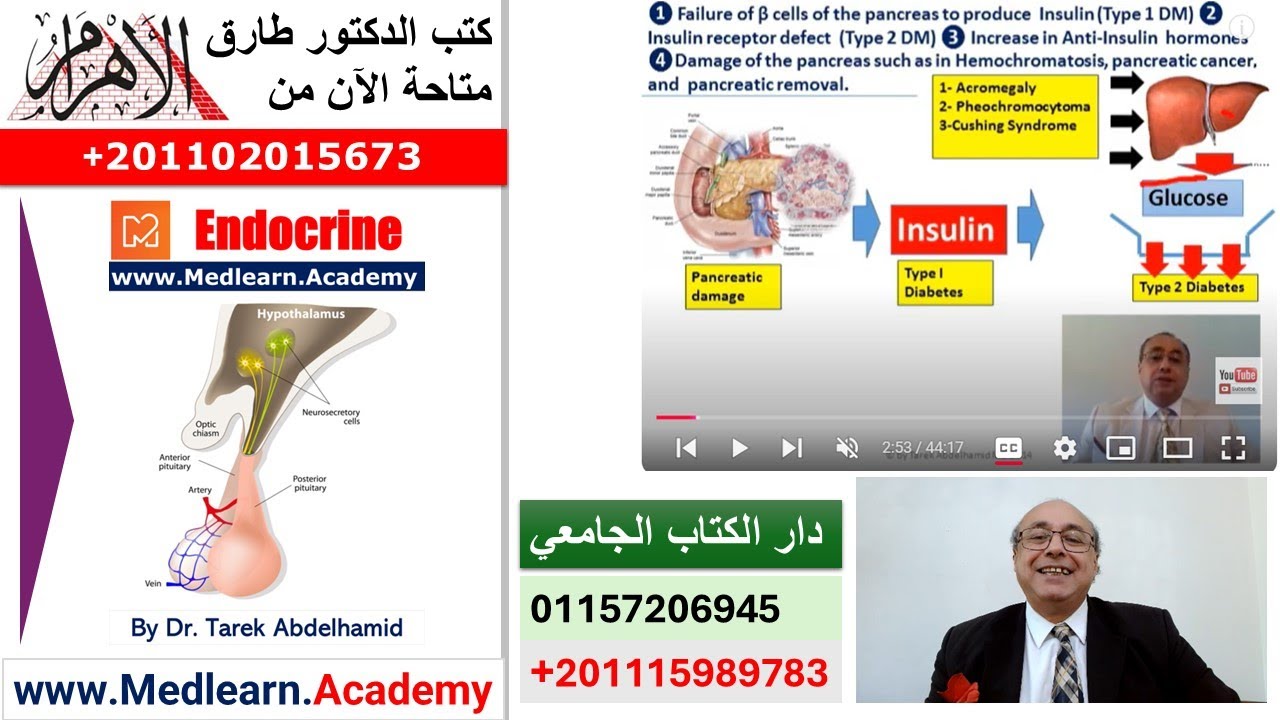 Diabetes Mellitus  (1) Introduction  #cme #internal_medicine #medical  #usmle #محاضرات_باطنة