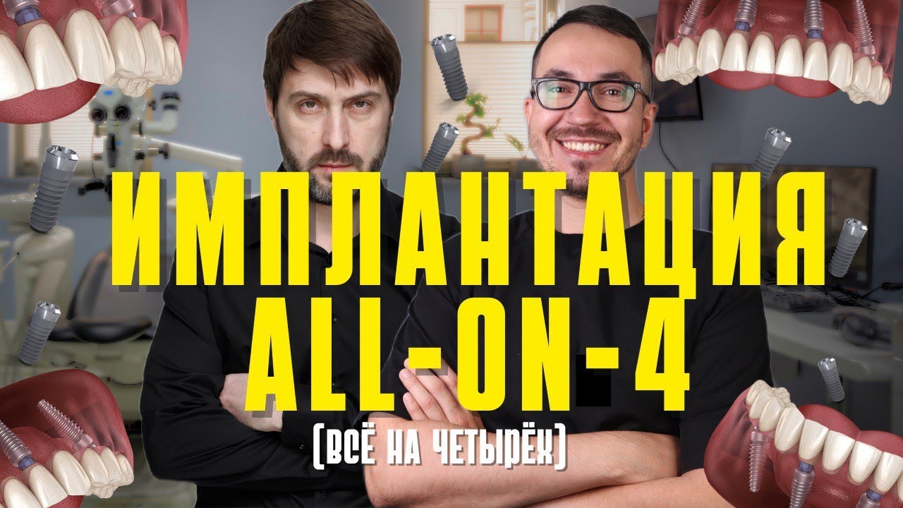 ИМПЛАНТАЦИЯ ЗУБОВ All-ON-4 | Всё на четырёх