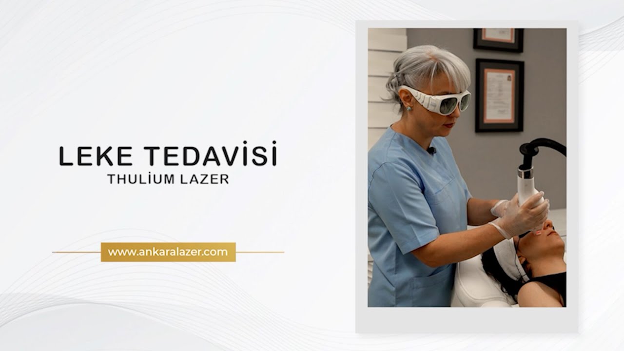 Thulium Lazer İle Leke Tedavisi -ANKARA LİFE