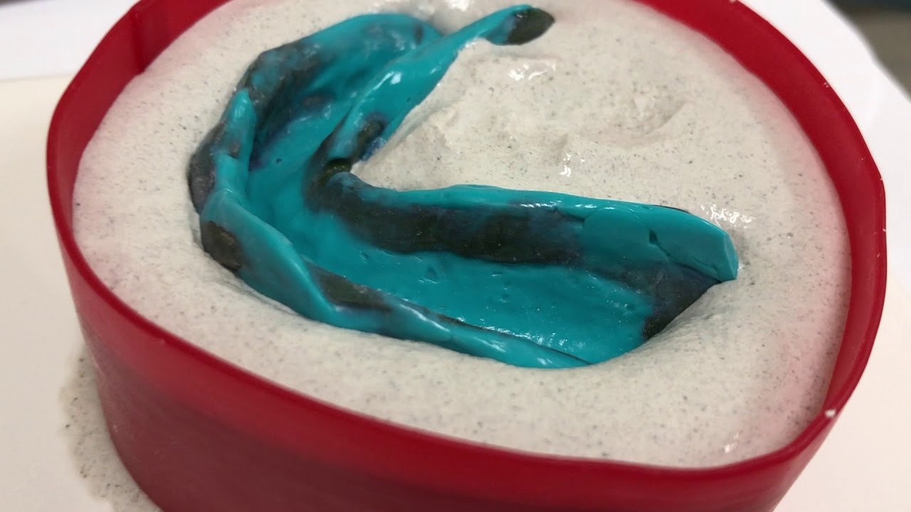 Boxing a Complete Denture Impression: Plaster and Pumice Technique