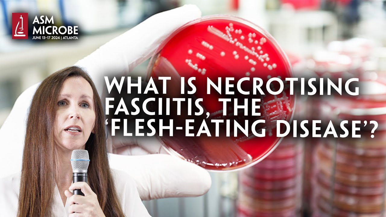 What Is Necrotising Fasciitis, The ‘Flesh-Eating Disease’?