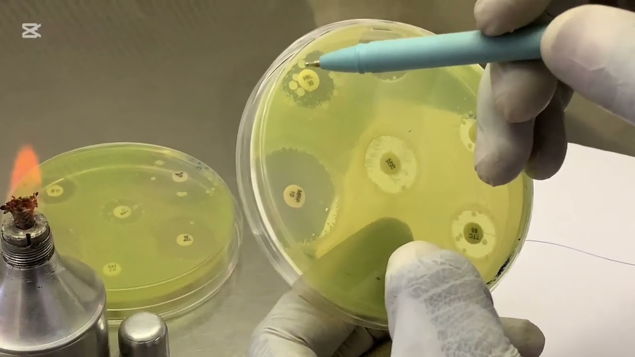 Comment faire la lecture et interpréter l antibiogramme tout en respectant les normes EUCAST#foryou 