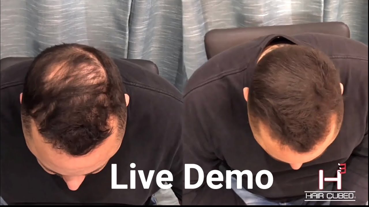 Live Demo: How to Make Thinning Hair Look Full Again 