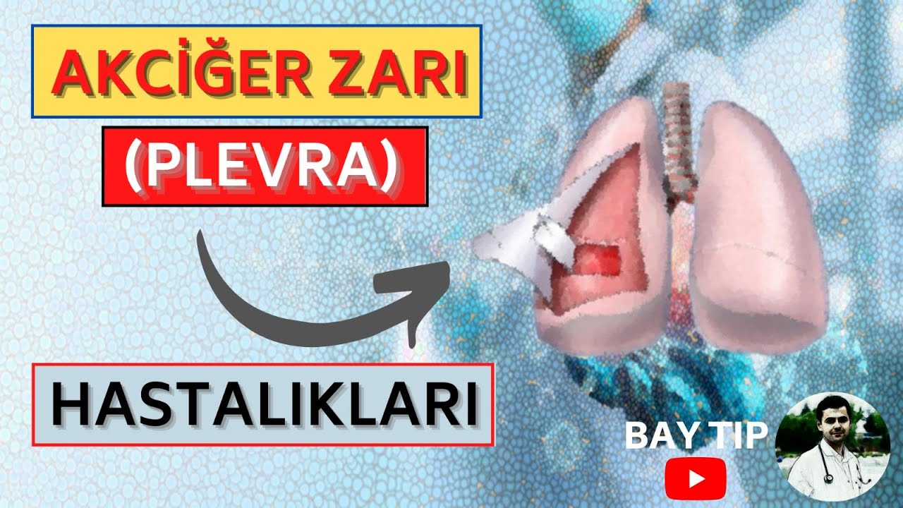 AKCİĞER ZARI (PLEVRA)  ve HASTALIKLARI NEDİR?