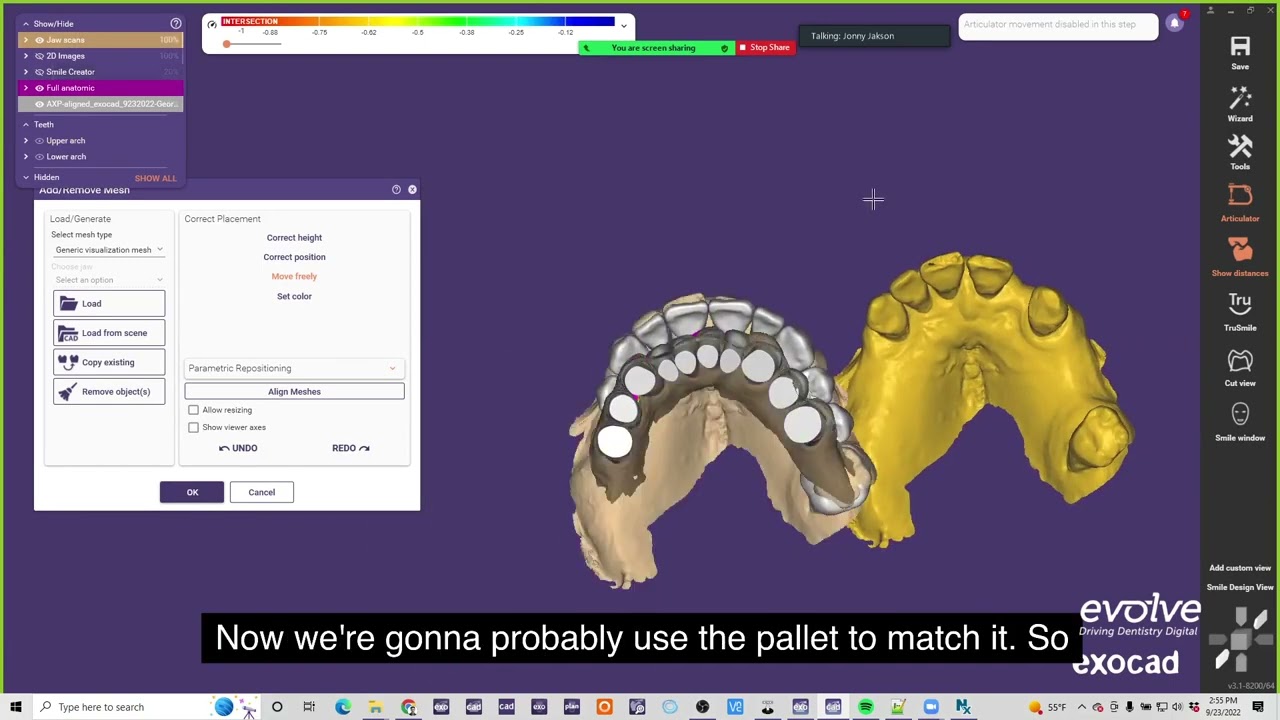 How to Export Tooth Molds and Change DB in exocad 3.1