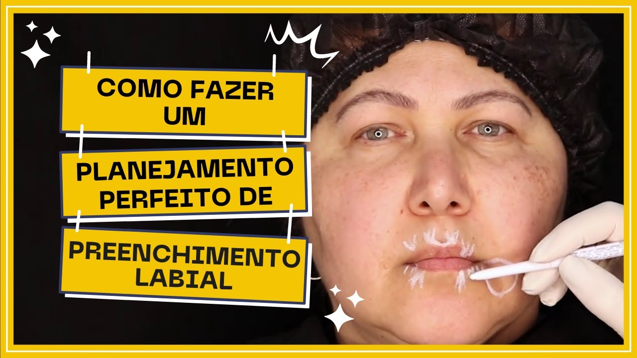 Aprenda a Fazer um Planejamento Perfeito para o Preenchimento Labial