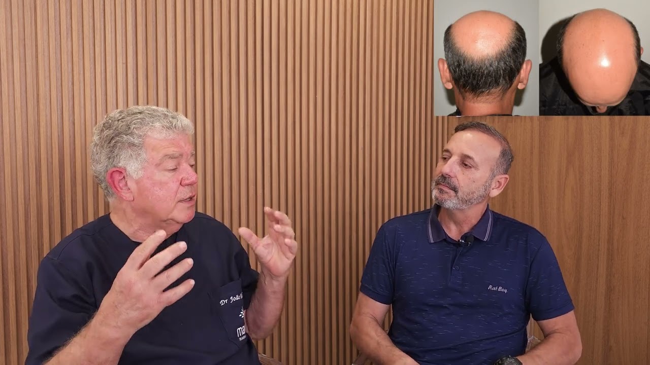 TRANSPLANTE CAPILAR (ESCLARECENDO DÚVIDAS)