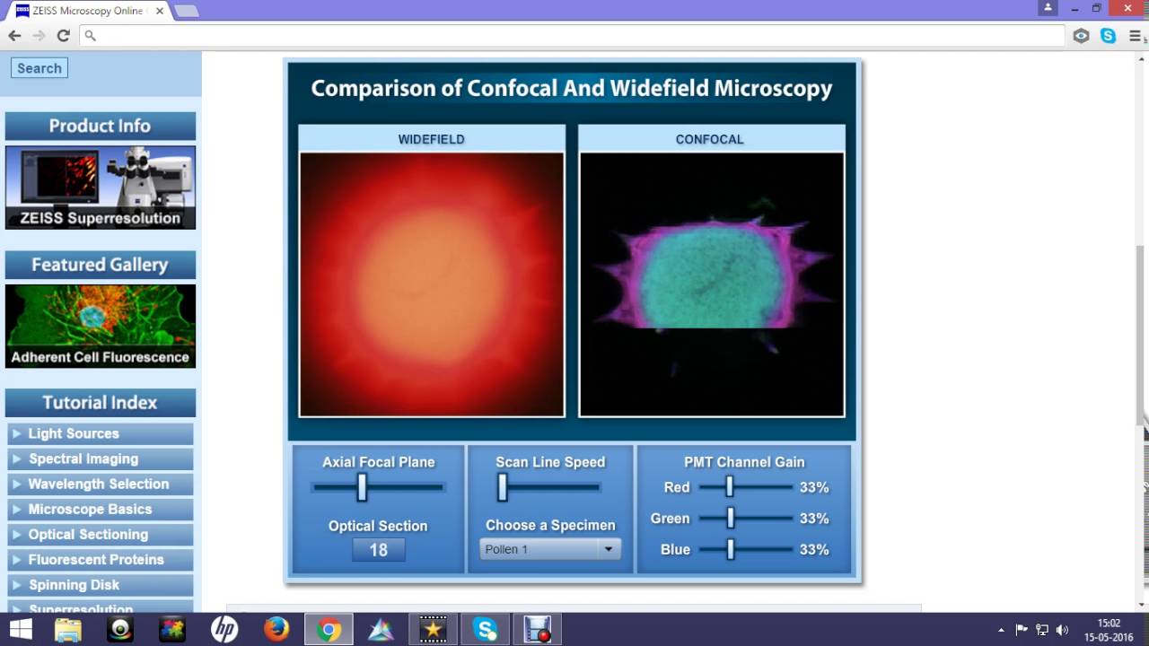 confocal vs widefield : difference in image quality