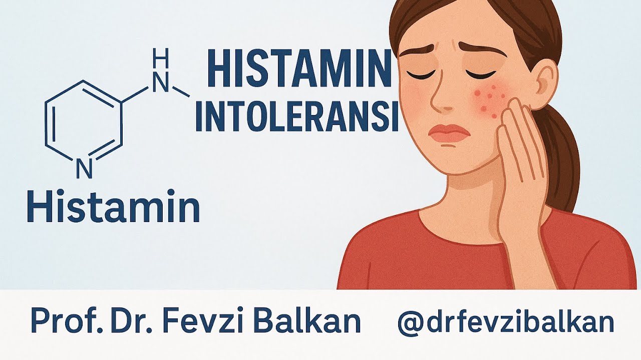 Histamin İntoleransı Sebepler -Belirtiler -Tedavi
