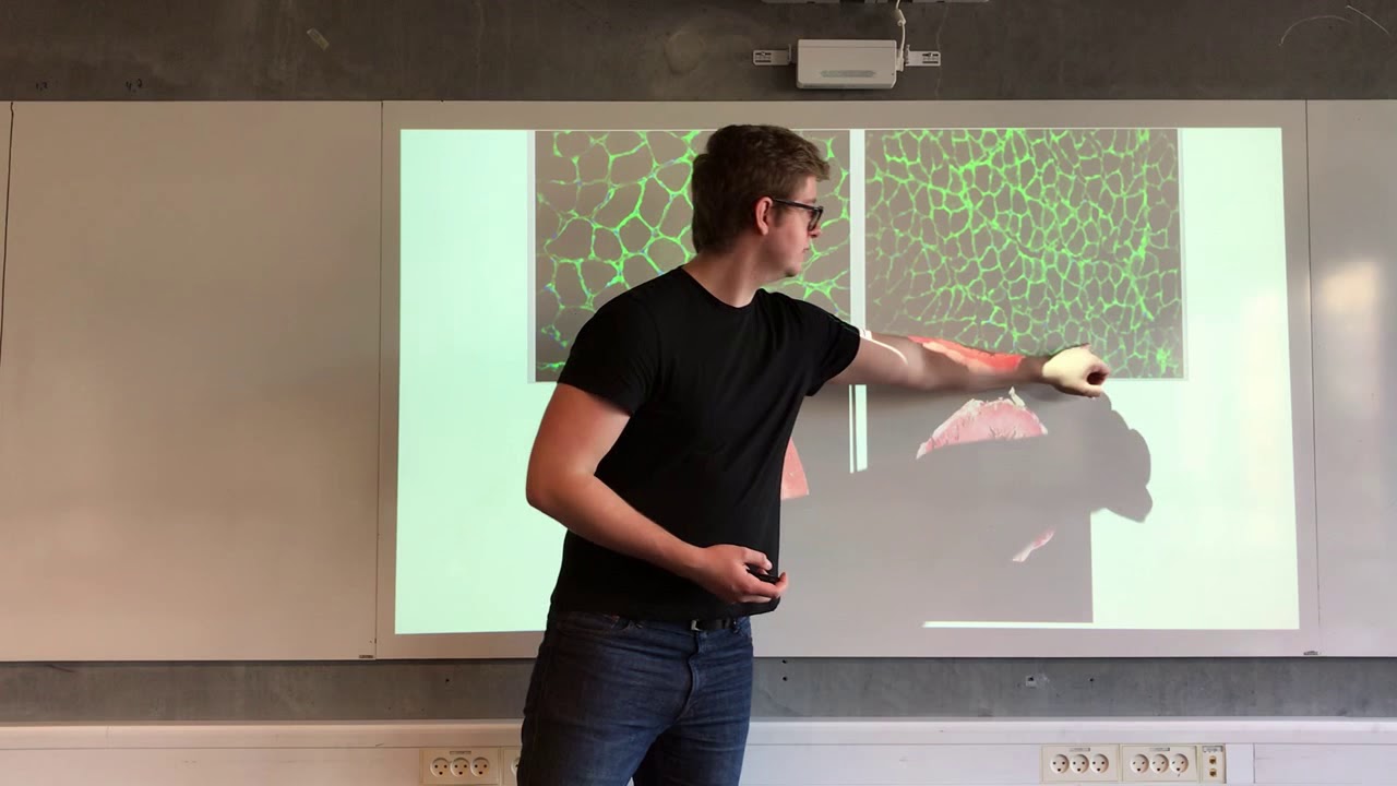 Cellulære adaptationer, celleskade og celledød