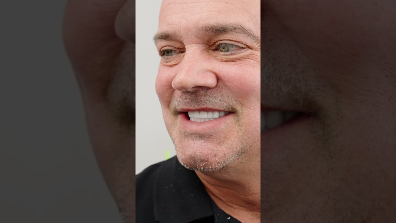Life-Changing Smile With Fixed Dental Implants | Houston, TX 