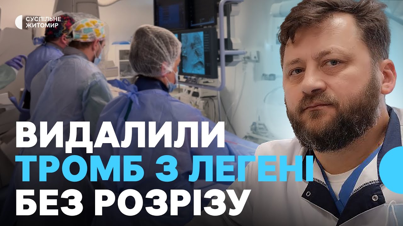 У Житомирі вперше видалили тромб з легеневої артерії без розрізу
