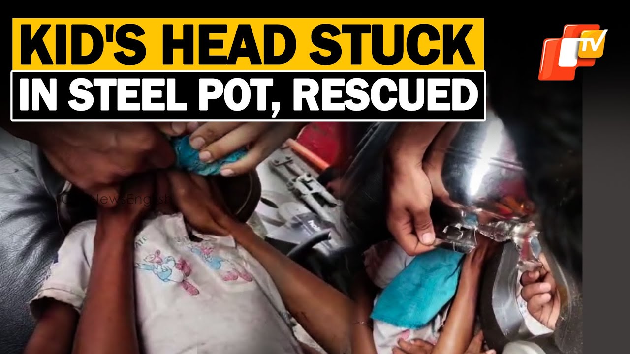 Child&rsquo;s Head Gets Stuck Inside Steel  Pot, Rescued by Fire Officials