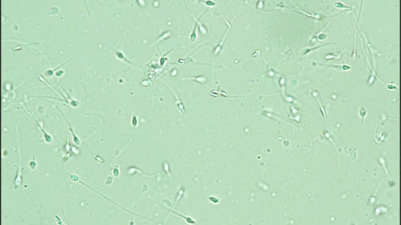 Sperm Motility Assessment exercise 2